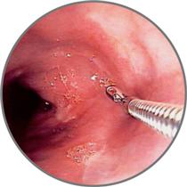 اختلال گوارشي و سوء هاضمه اختلال گوارشي و سوء هاضمه