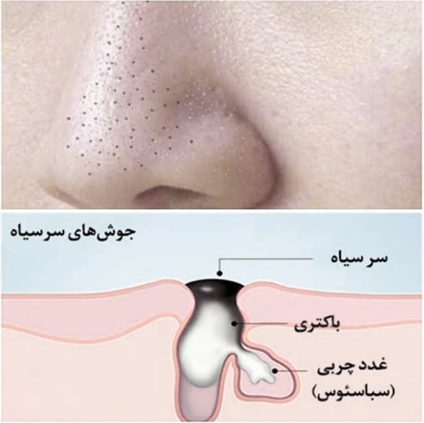 تصویر اصلی 